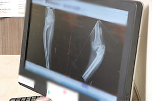 before and after xrays